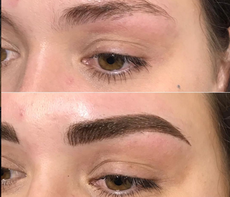 Combo Brows - Brows by Nettie - About Face Clinic